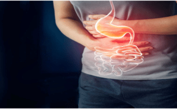 Diet for gastritis of the stomach
